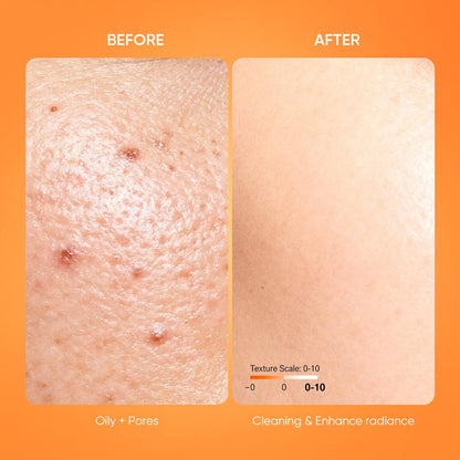🔥Orange Enzyme ExfoliatingGel - The Gentle Miracle YourSkin Has Been Crying Out For