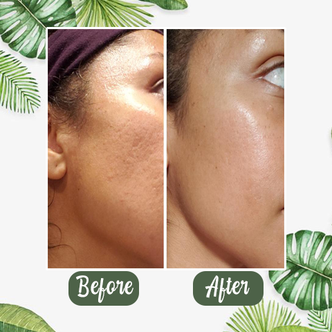 Final Sale - Green TeaDeep Cleanse Mask -(Limited time discount🔥last day)
